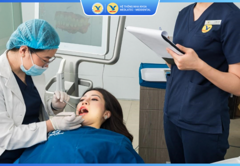 Rạn Men Răng – Tổn Thương Âm Thầm Nhưng Không Nên Chủ Quan